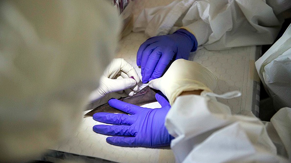 WHO Coronavirus Pandemic Origin