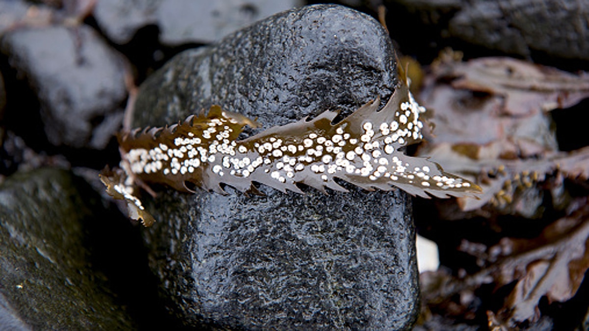 Deadly Hospital Superbug on Andaman Island