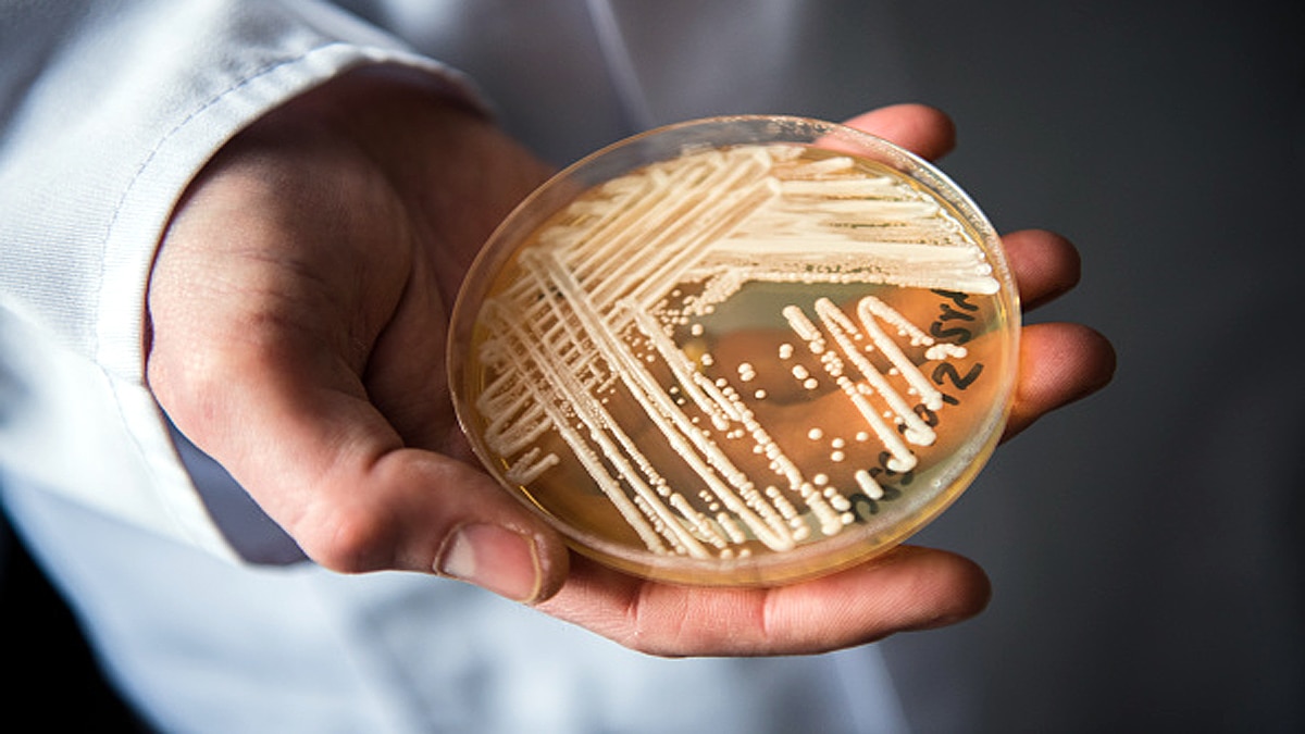 Deadly Hospital Superbug in Andaman Island