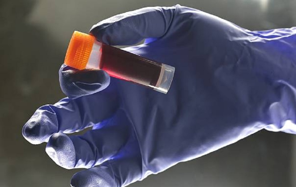 डायबिटीज 3