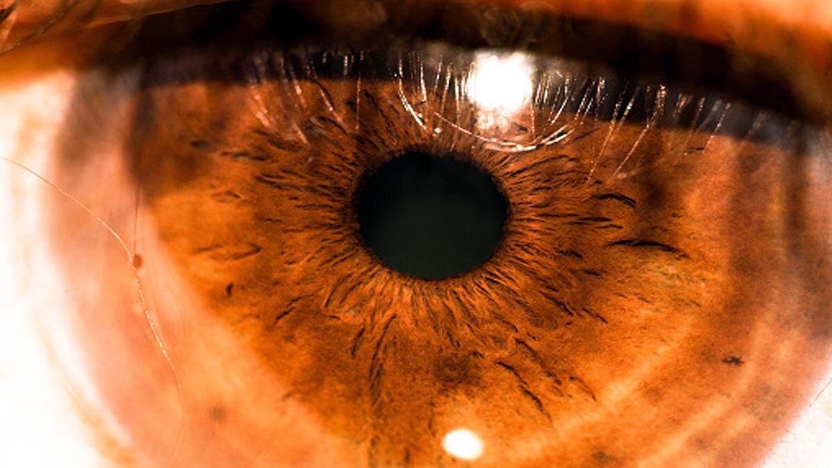 Artificial Intelligence detect Diabetes of Eyes