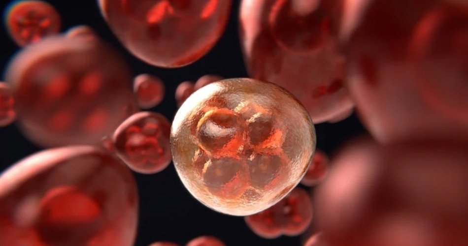 मोजेक डाउन सिंड्रोम