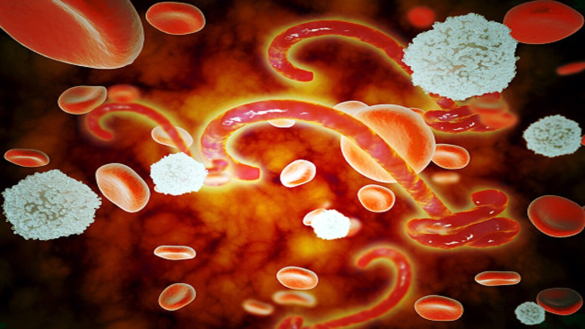 Ebola Lingered in Survivor for 5 years 