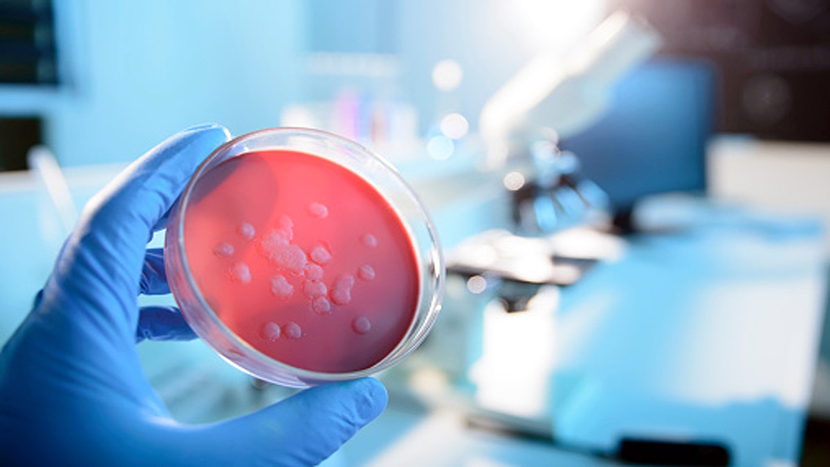 Ebola Lingered in Survivor for 5 years 