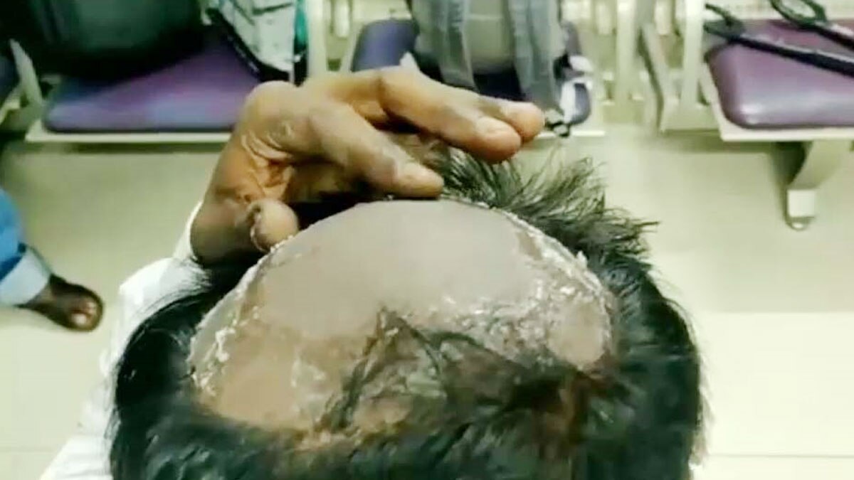 (विग में छुपाकर सोने की स्मगलिंग (फोटो- प्रमोद माधव)