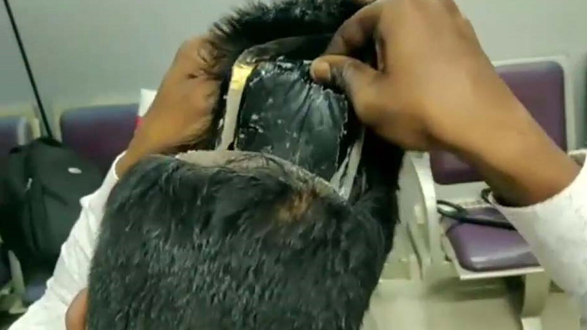  रविवार को दो लोग विग के नीचे सोना छिपाकर ले जाते पकड़े गए