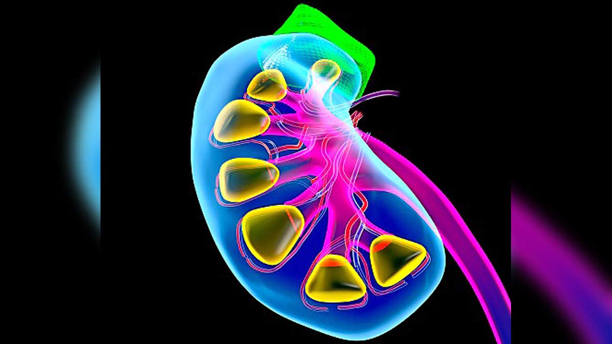 Kidney Diseases cured Ayurvedic Formula