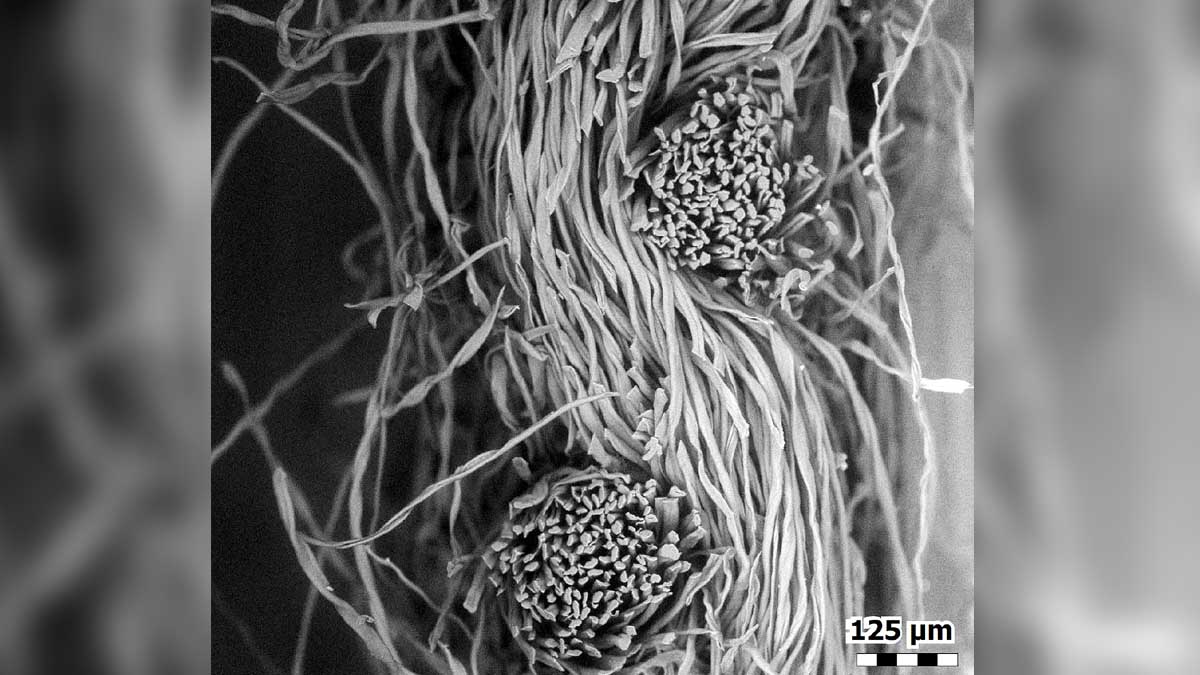 How a Face Mask Looks Under an Electron Microscope