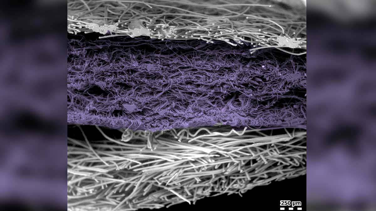 How a Face Mask Looks Under an Electron Microscope
