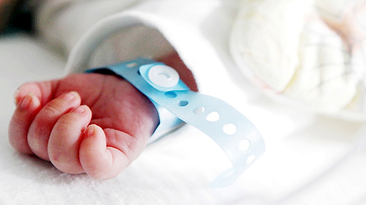 Mermaid Baby born in Hyderabad