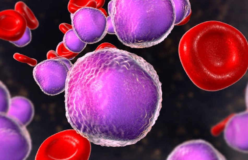 माउथ कैंसर 5