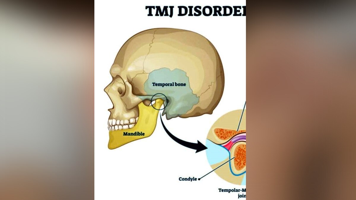 30 साल बाद महिला ने खोला मुंह, खून भरी नसों से भरा हुआ था चेहरा