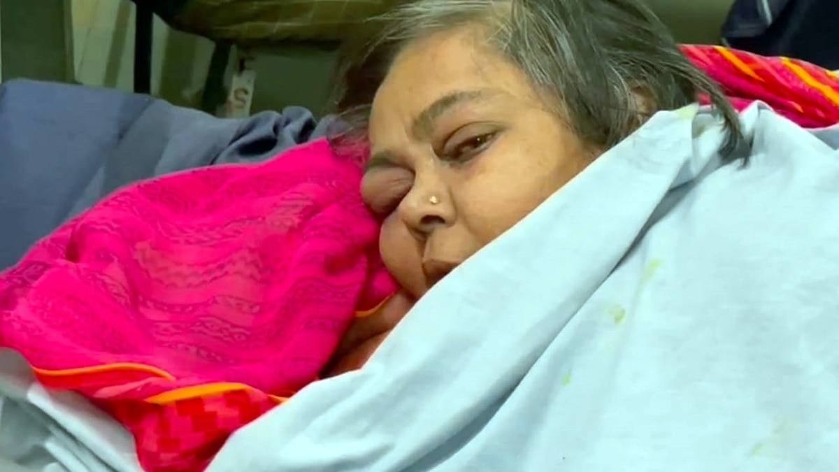 300 KG woman rescued in Rajkot