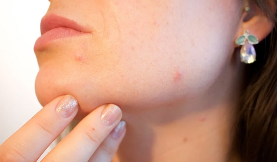 त्वचा संबंधी समस्या को करे ठीक