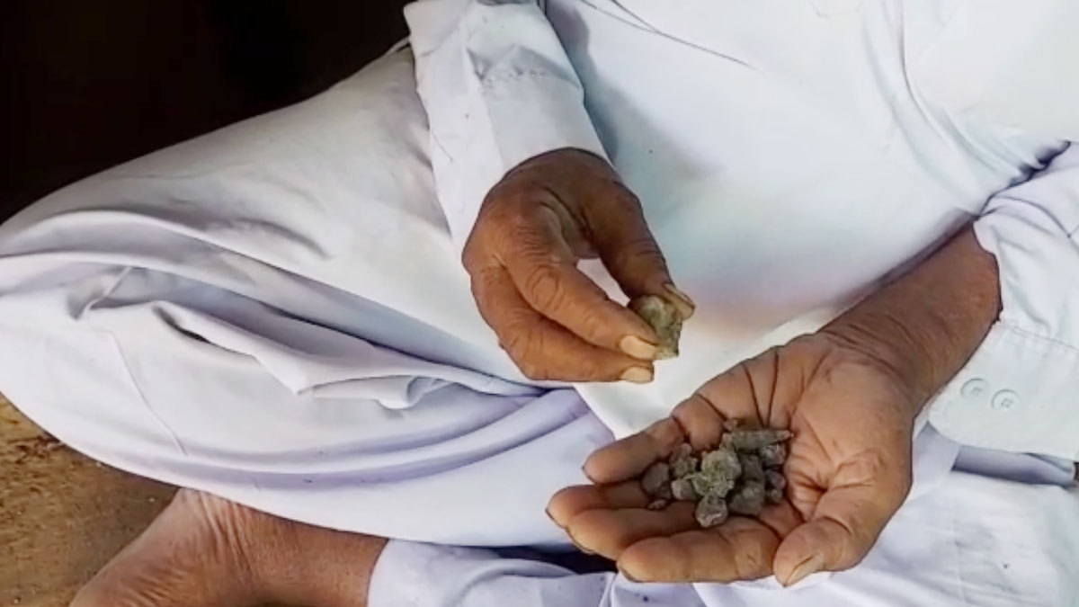  बुजुर्ग रोज खाता है 250 ग्राम पत्थर (फोटो- पंकज खेलकर)