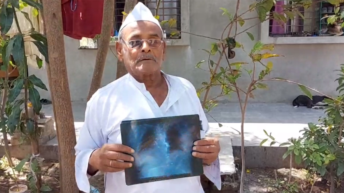 बुजुर्ग रोज खाता है 250 ग्राम पत्थर (फोटो- पंकज खेलकर)