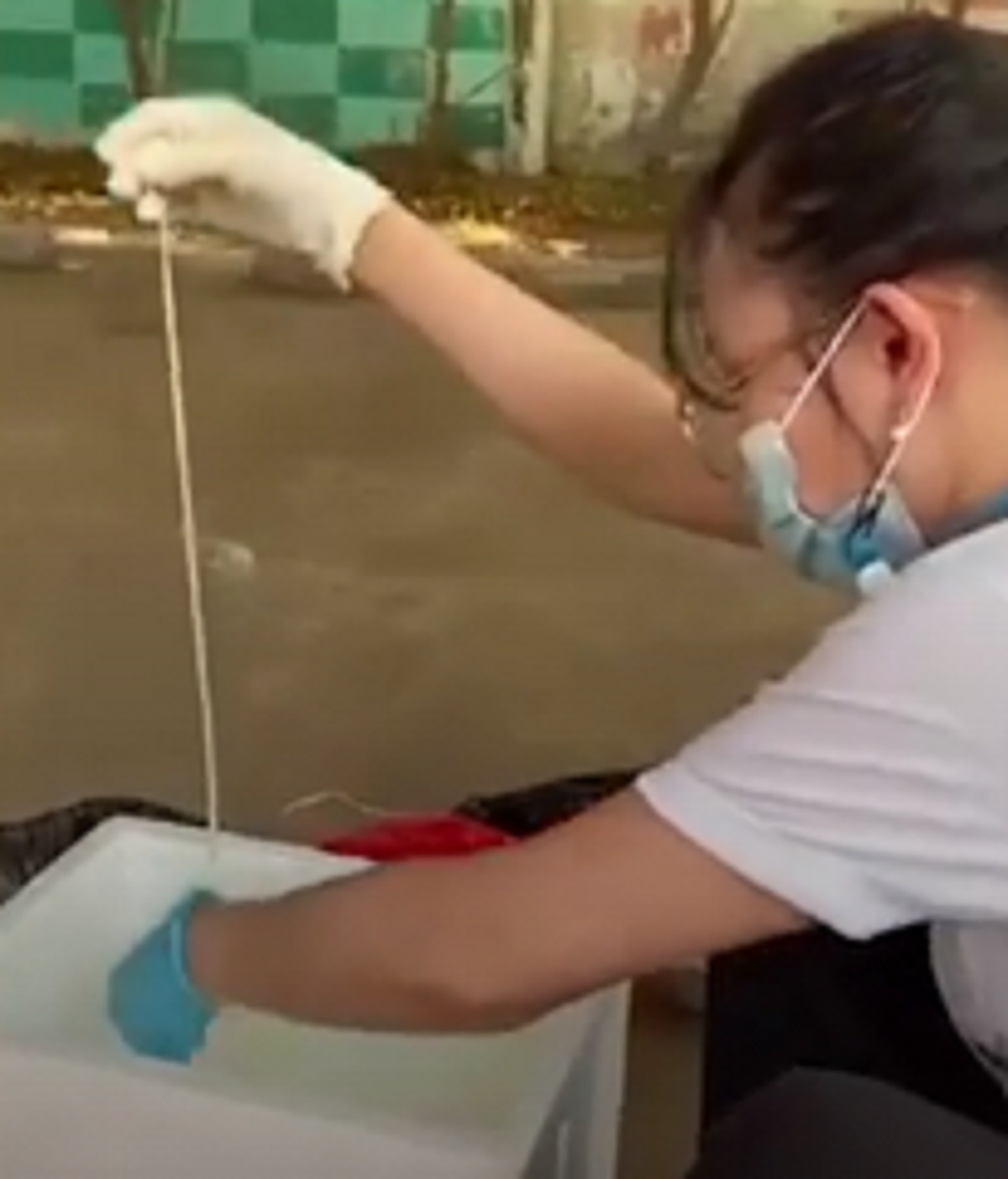 डॉक्टर्स ने प्राइवेट पार्ट से निकाला 59 फीट का कीड़ा