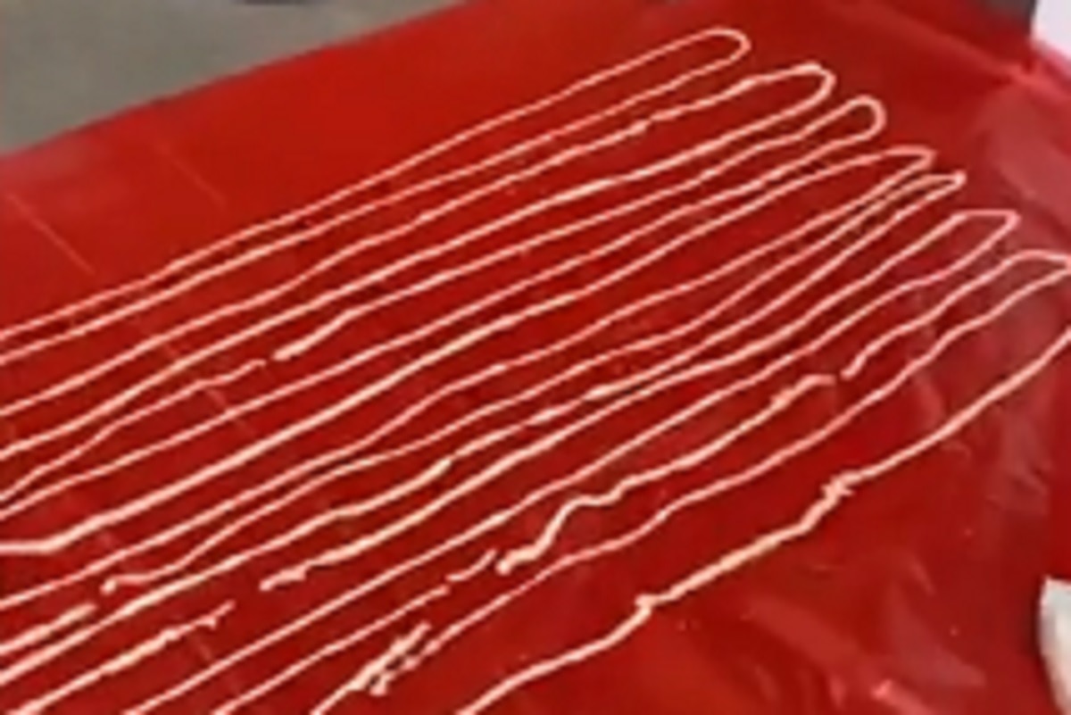 डॉक्टर्स ने प्राइवेट पार्ट से निकाला 59 फीट का कीड़ा