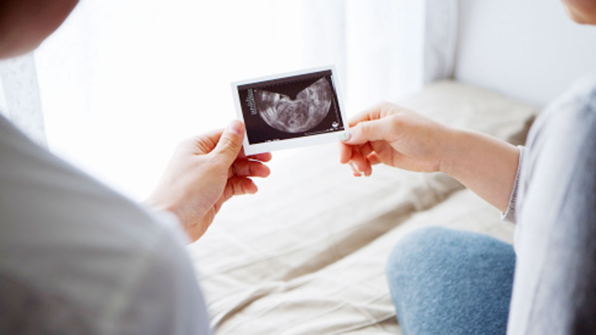 Credit- Getty ImagesRepresentative