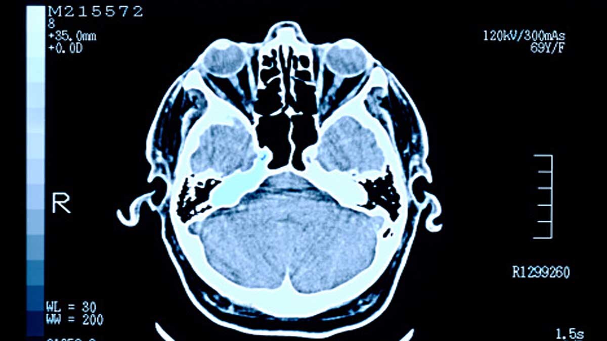 Why Human Brain is so Big?