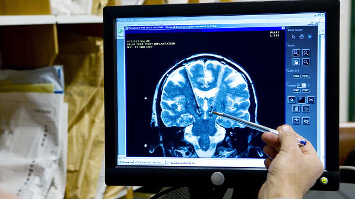 Why Human Brain is so Big?