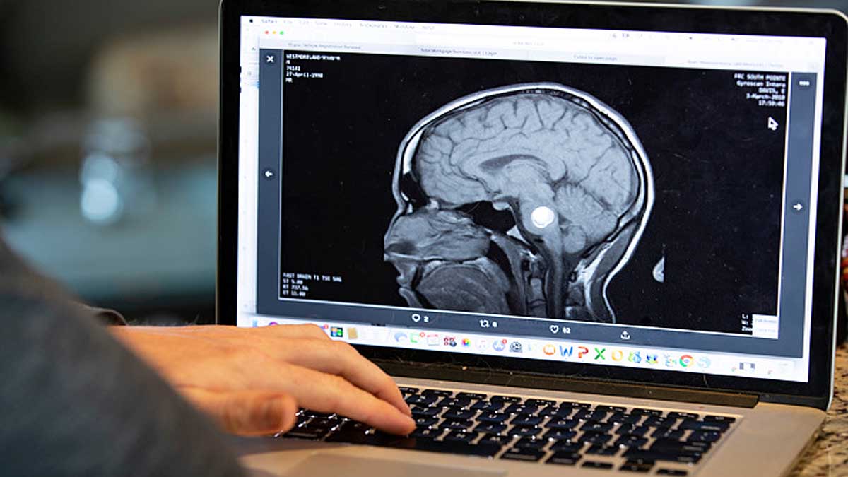 Why Human Brain is so Big?