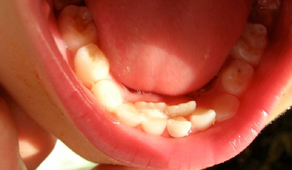 Guinness World Records 