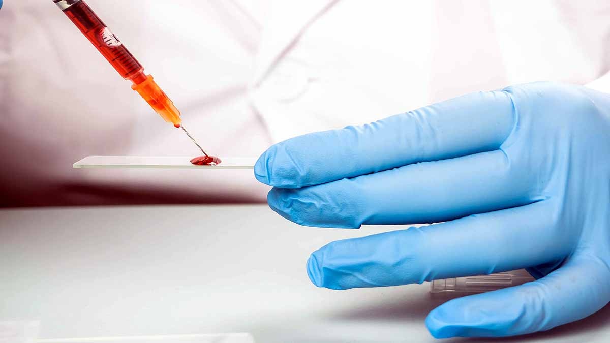 Type A Blood group universal Donor