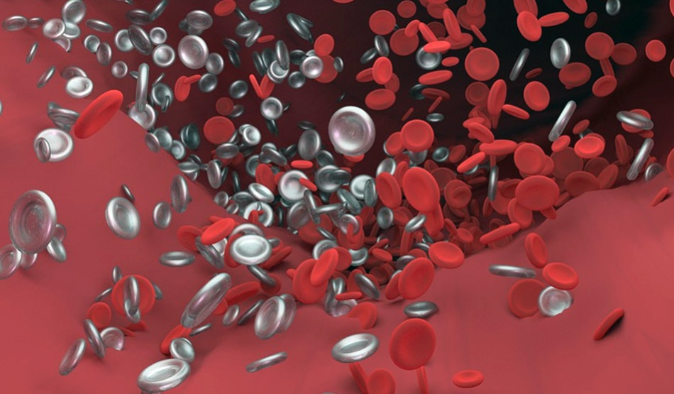 सेरेब्रल वेनस साइनस थ्रोम्बोसिस