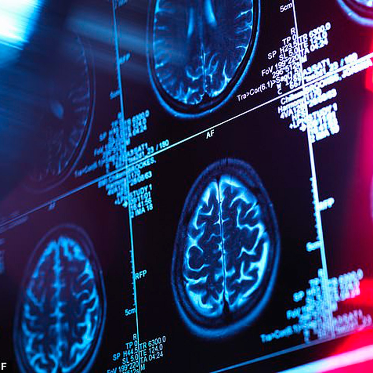 mysterious disease in canada