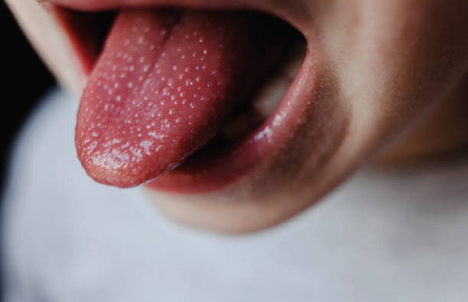 कोविड टंग