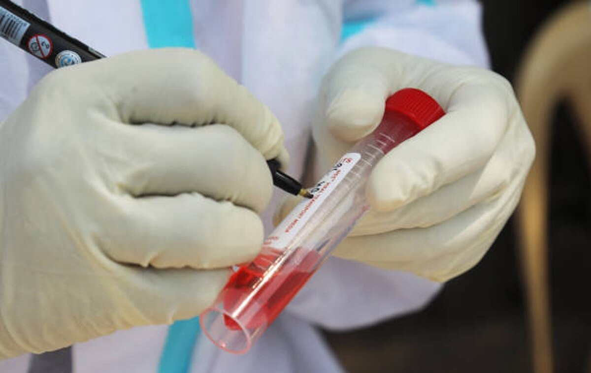 रिपोर्ट नेगेटिव आने पर भी रहें सतर्क