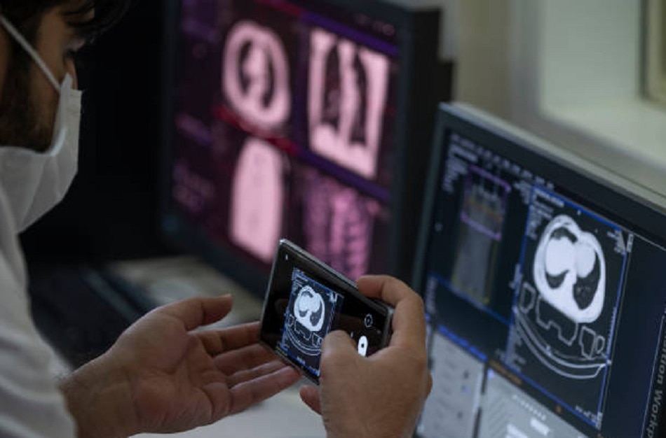 कोरोना वायरस 5