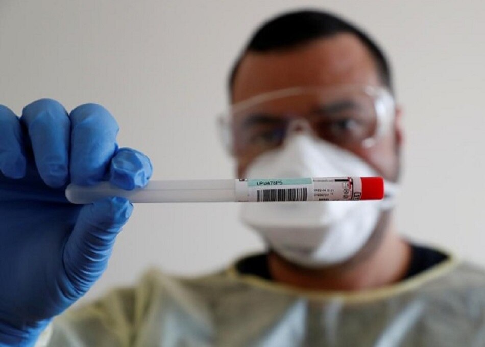 कोरोना वायरस 4