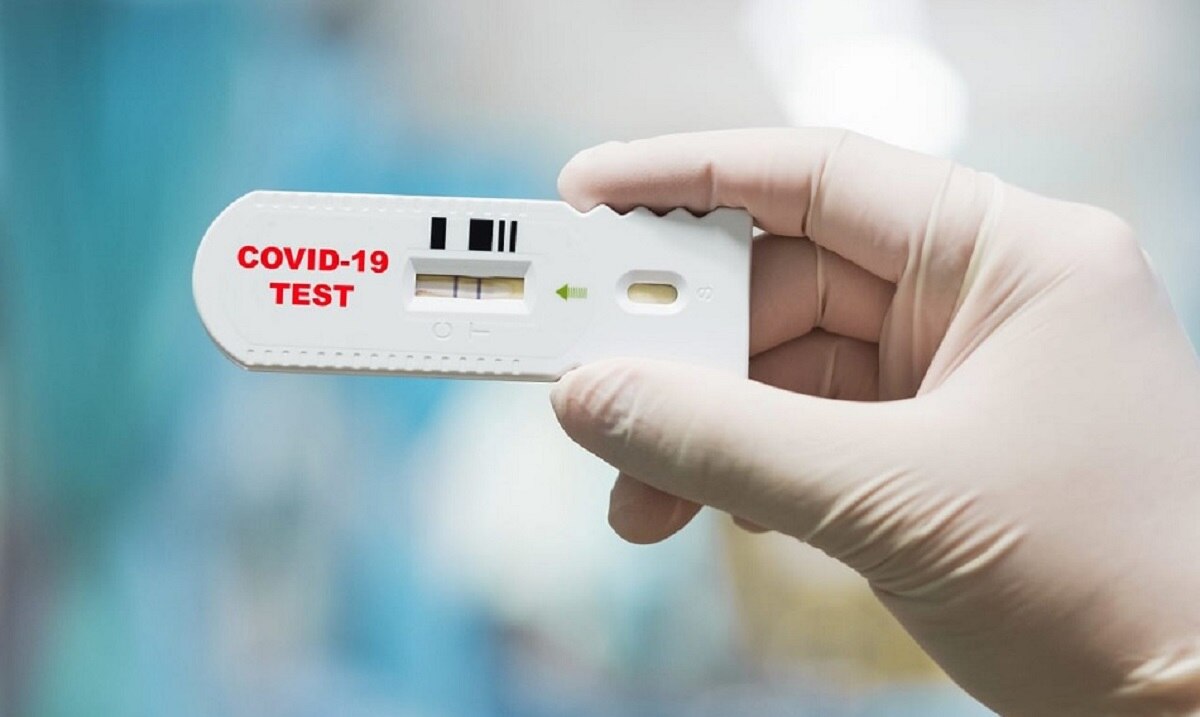 कोरोना वायरस 2