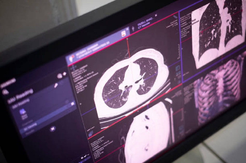 कोरोना वायरस 3