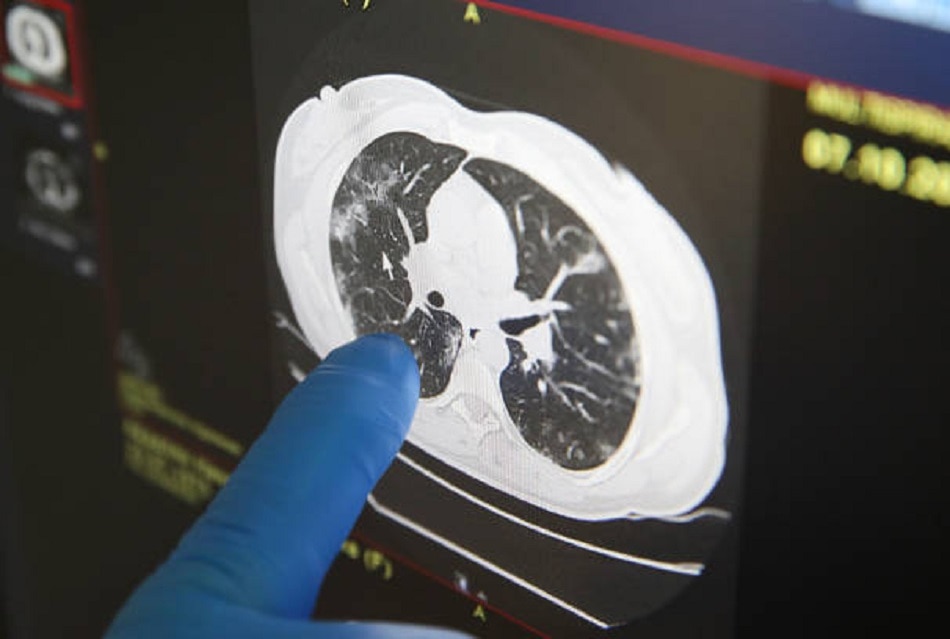 कोरोना वायरस 8