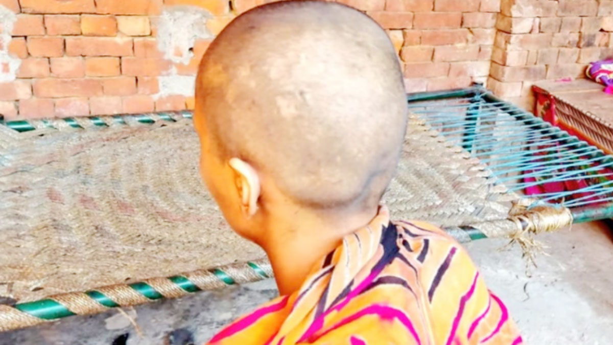 पिता ने बेटी की चोटी काटी फिर उस्तरे से किया गंजा  