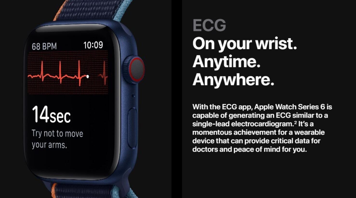 ECG Smartwatch