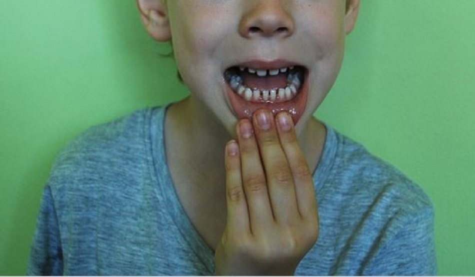 Guinness World Records 