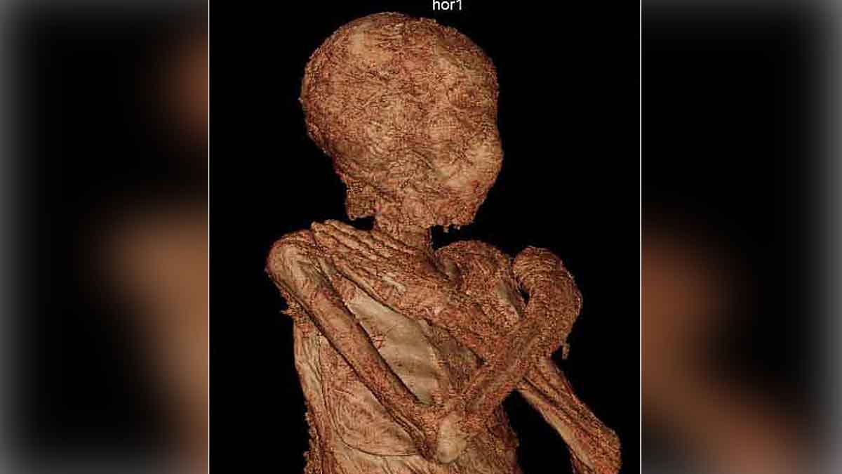 Egyptian Mummy Pregnant Woman