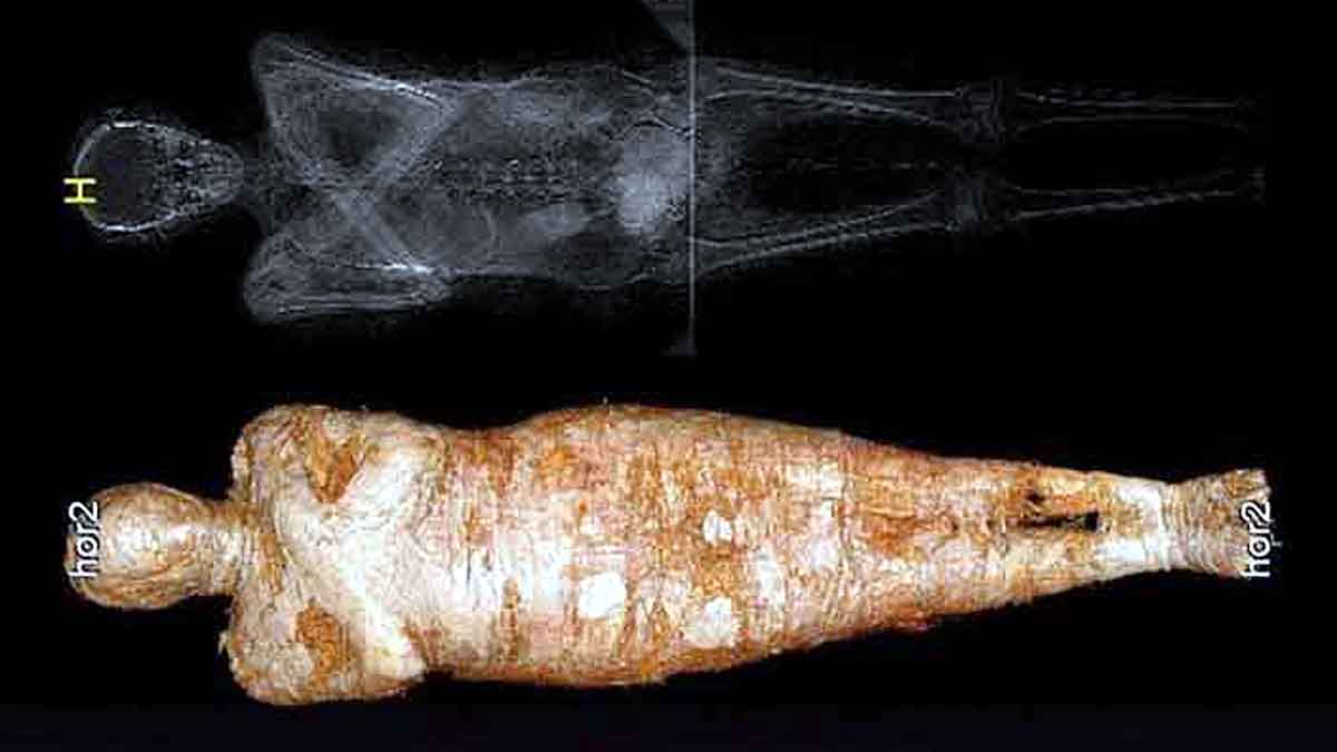 Egyptian Mummy Pregnant Woman