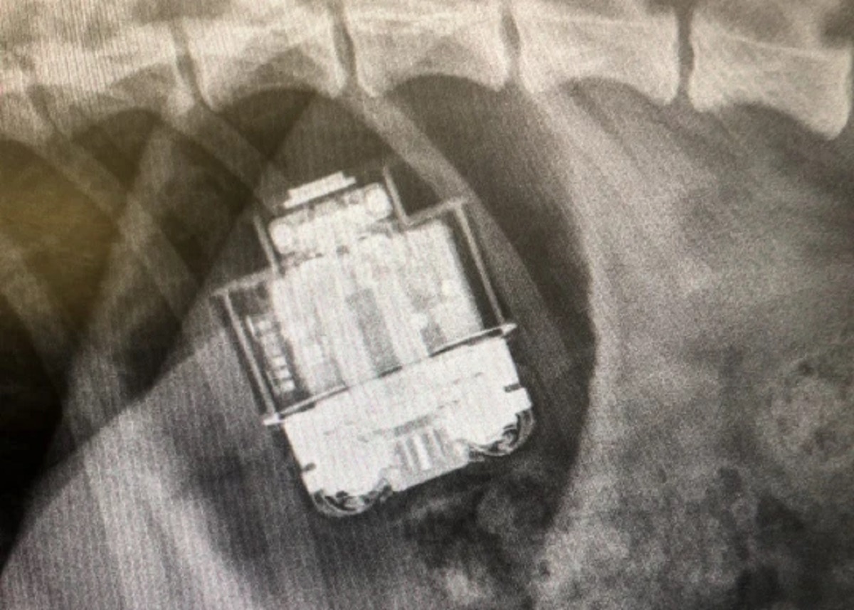 Dog swallowed airpods