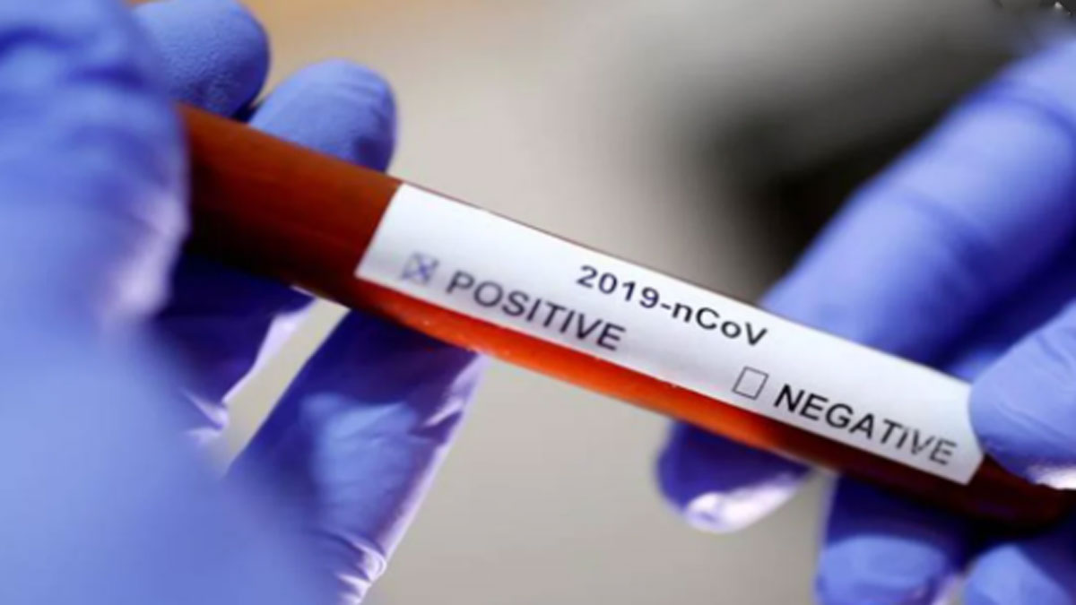 (प्रतीकात्मक फोटो)