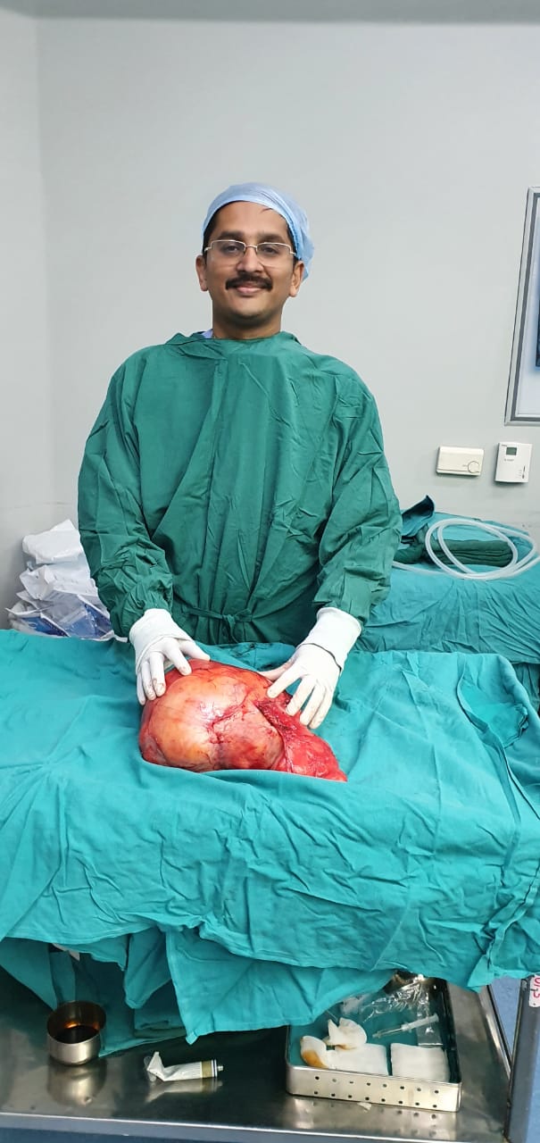 डॉक्टरों ने लड़की पेट से दो फुटबॉल के बराबर ट्यूमर निकाला 