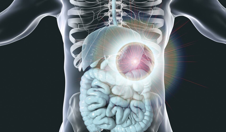  Representative Getty Images 