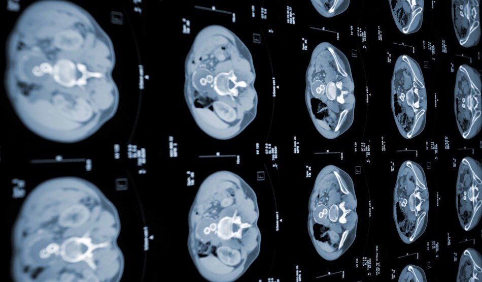  Representative Getty Images 