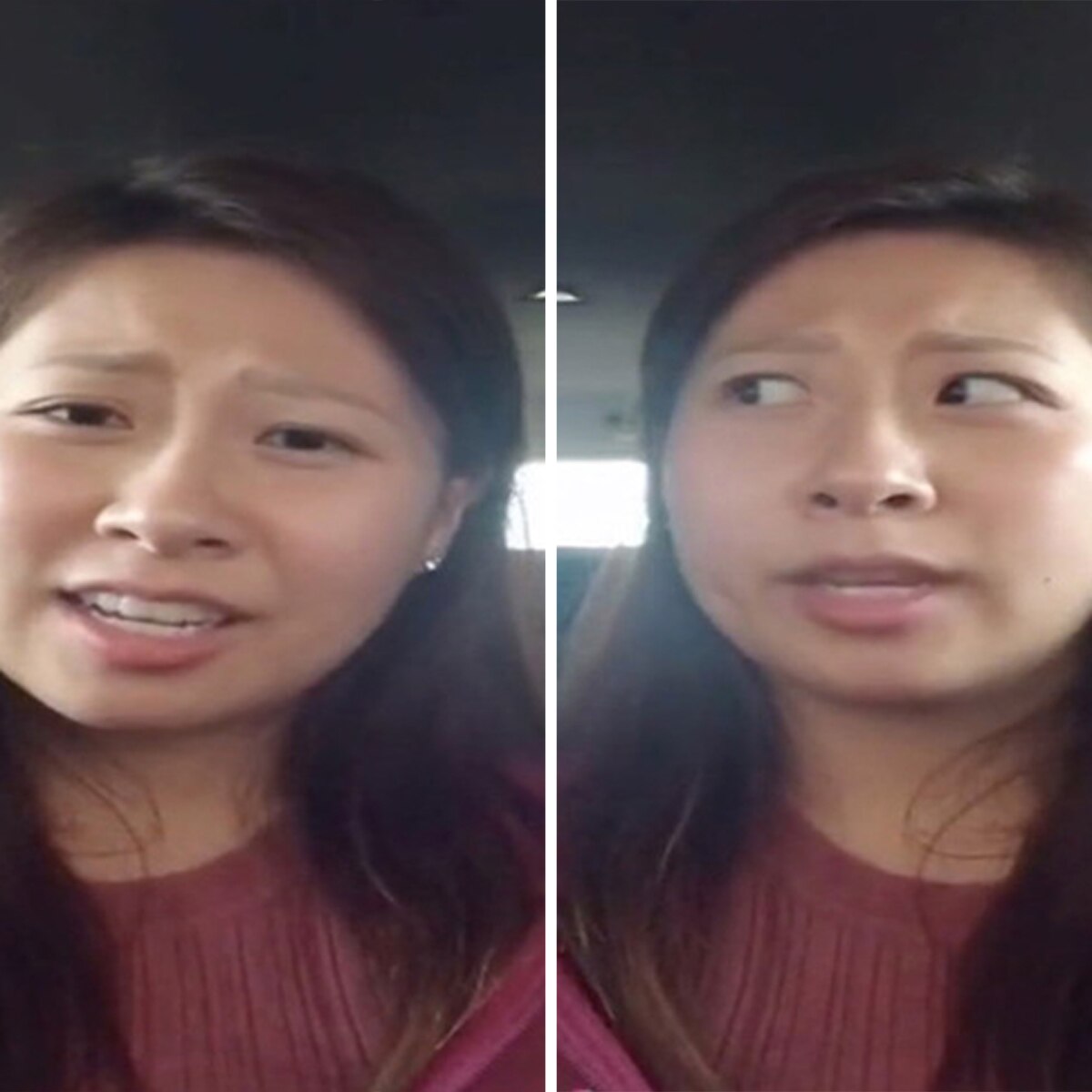 Woman accent change after surgery