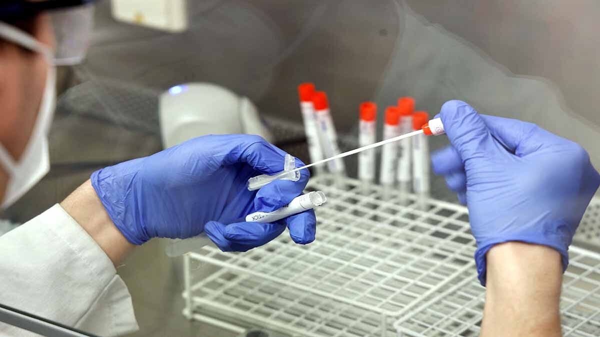 First Image of B.1.1.7 Variant