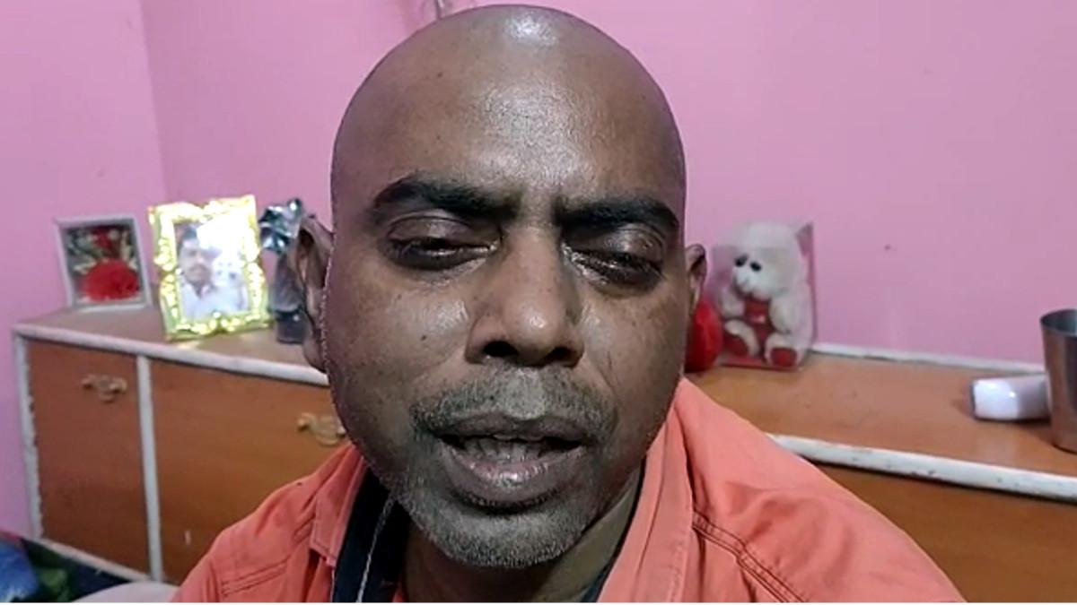 ब्लैक फंगस से आंखों की रोशनी गई.